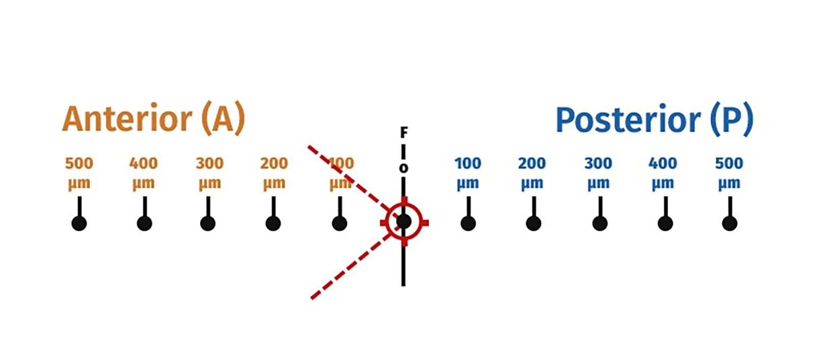 wide-range-anterior-and-posterior-offset.jpg